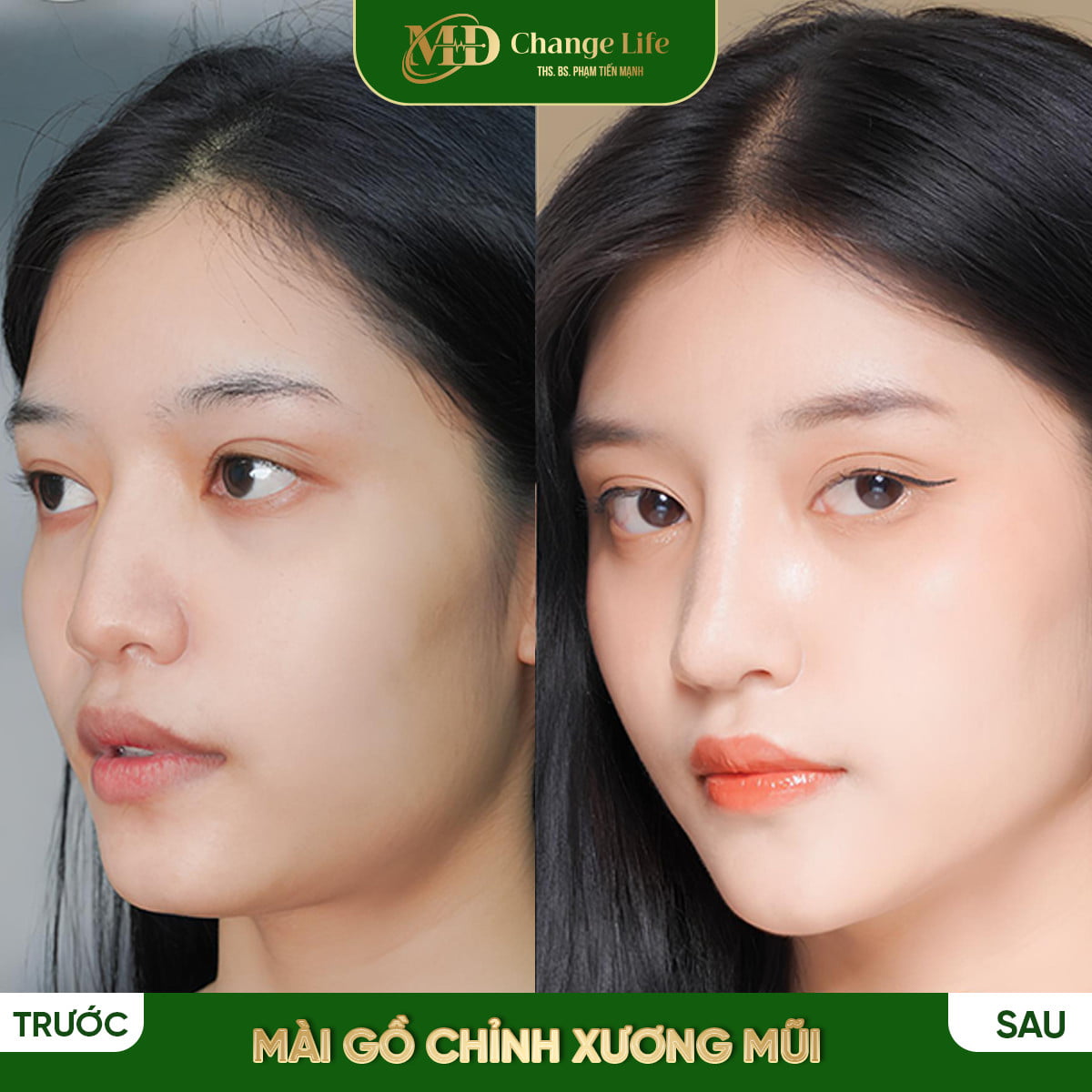 Trang chủ
