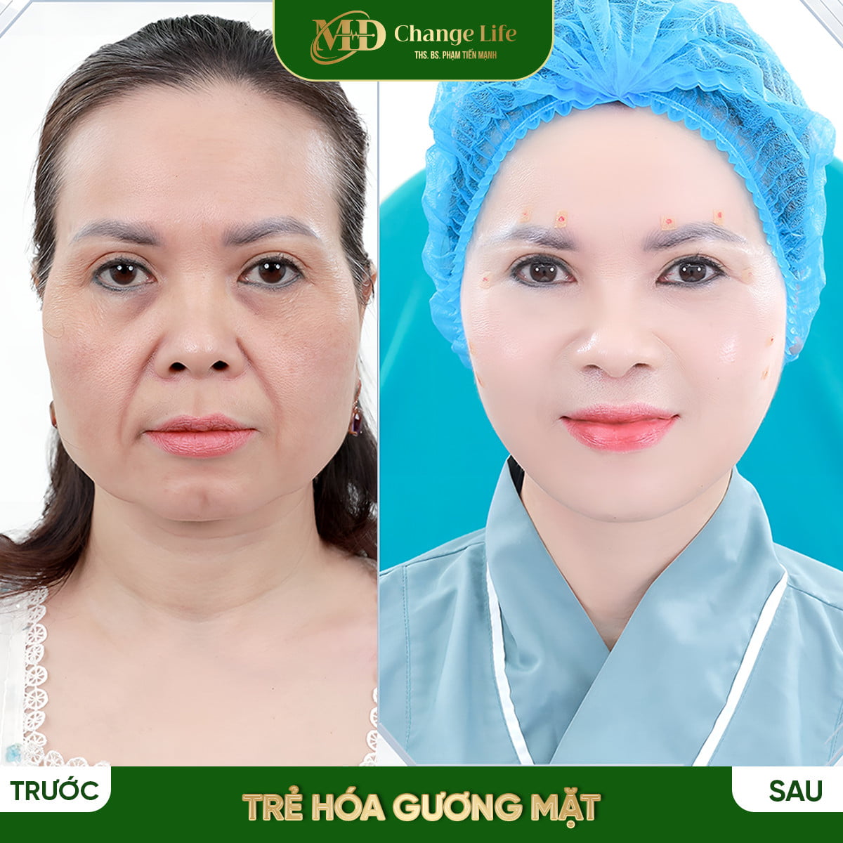 Trang chủ